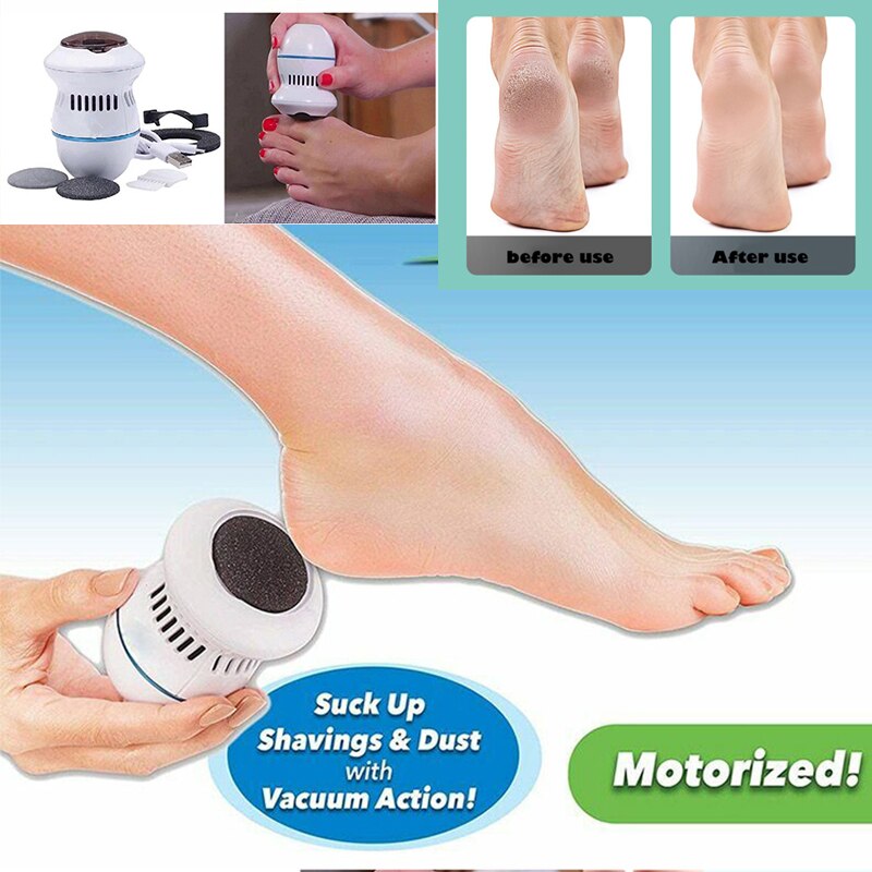 Electric Vacuum Foot Grinder dead skin